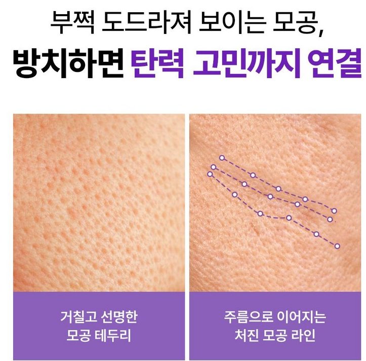 메디힐 PDRN 모공 탄력 세럼의 제형과 사용 전후 피부 상태
